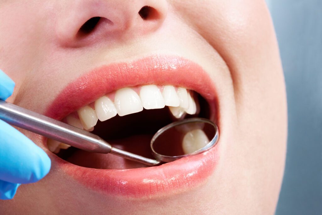 Close-up of open mouth during oral checkup at the dentist’s
