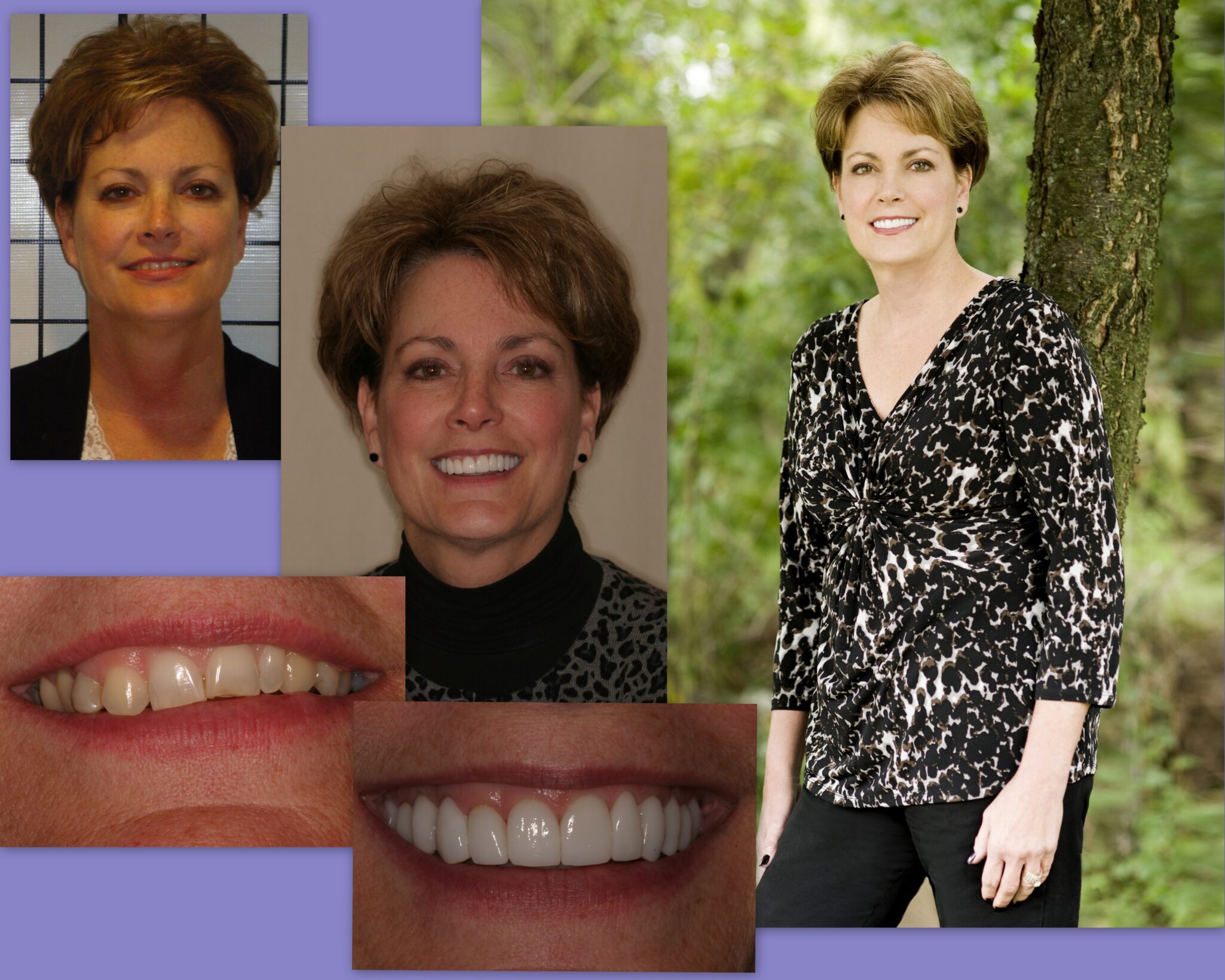 Before and after photos of female client