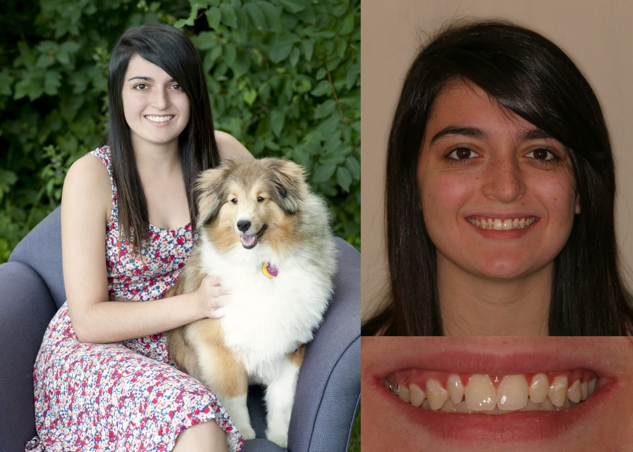 Before and after photos of young female client