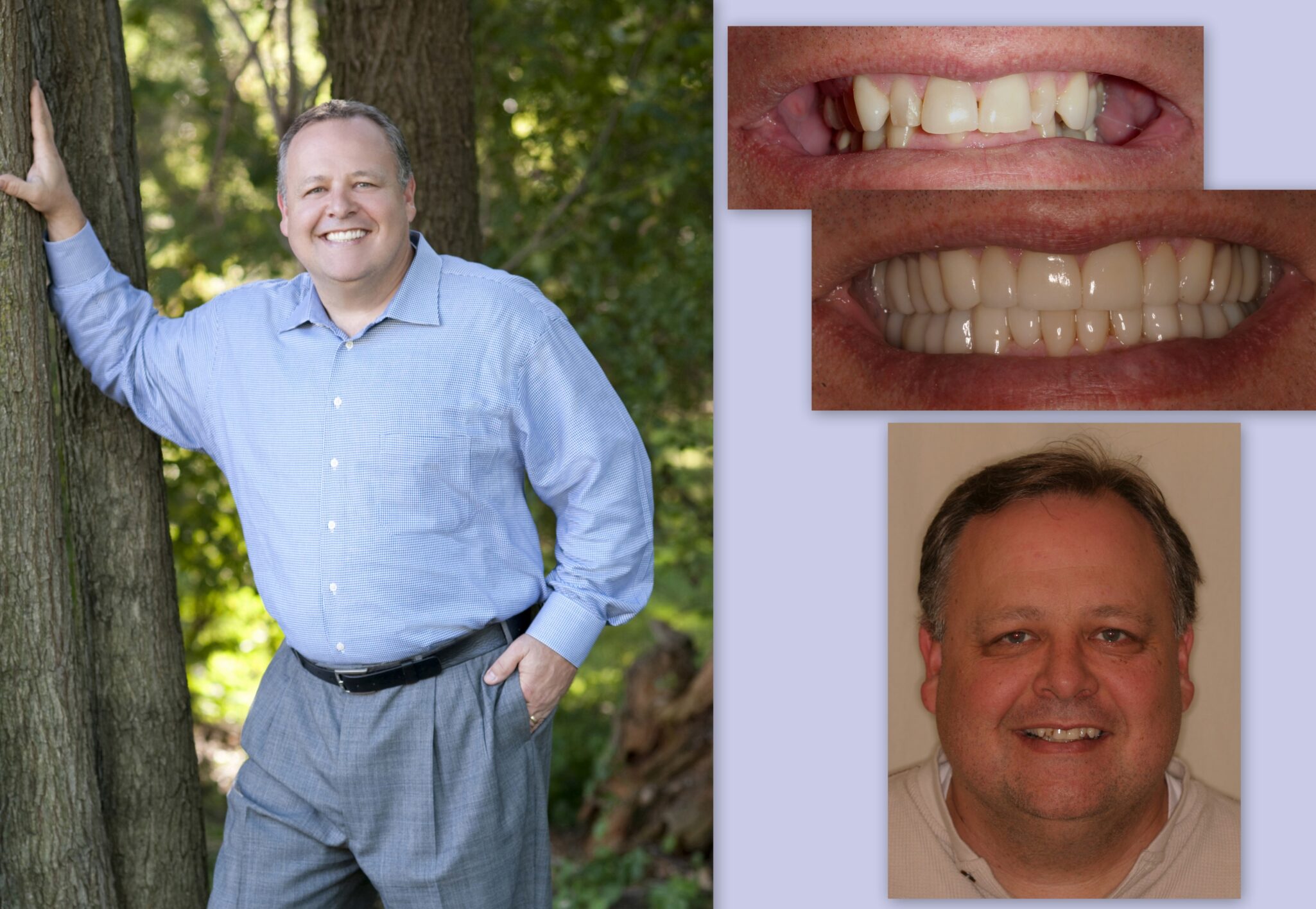 Before and after dental photos of male client