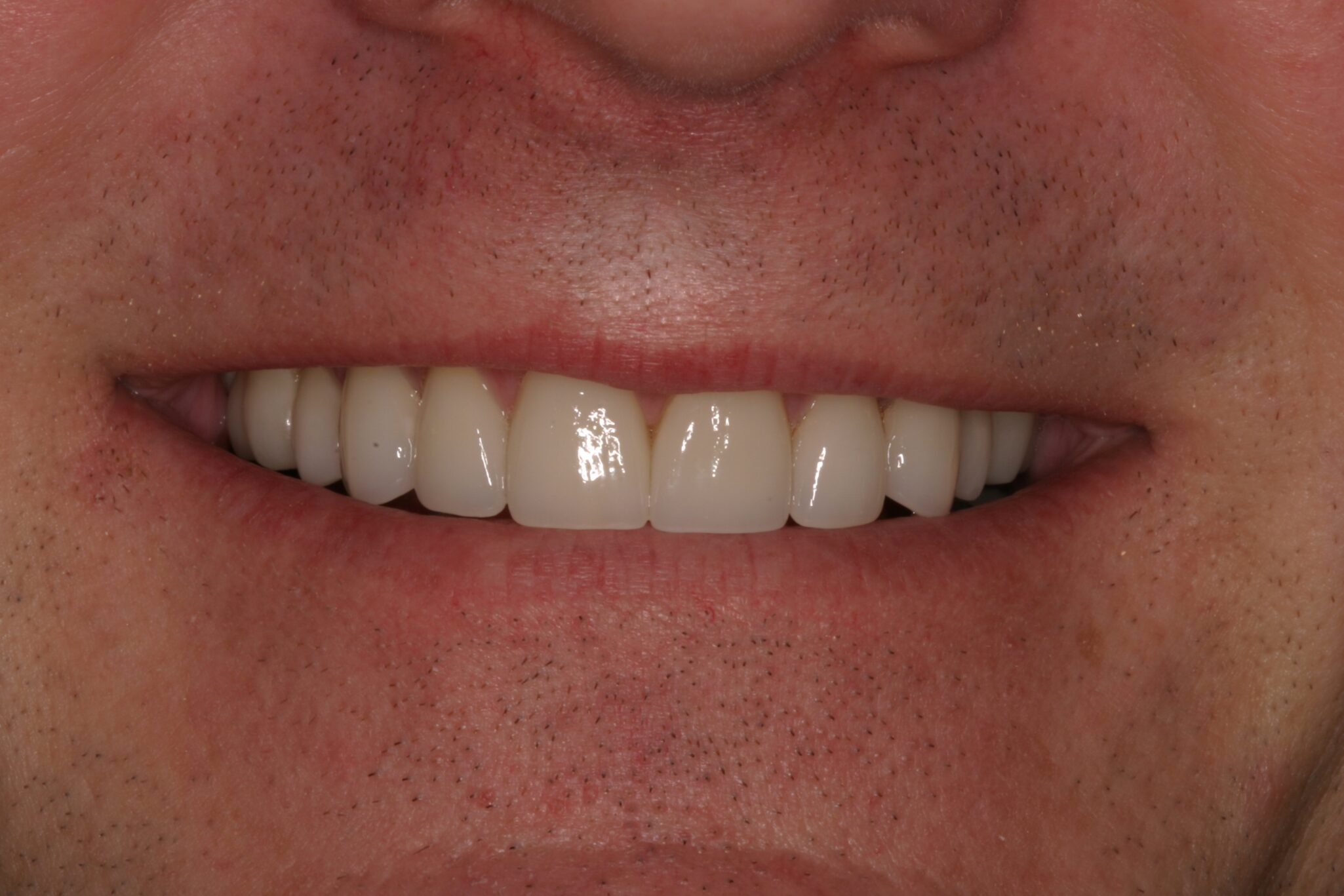 After photo of male client