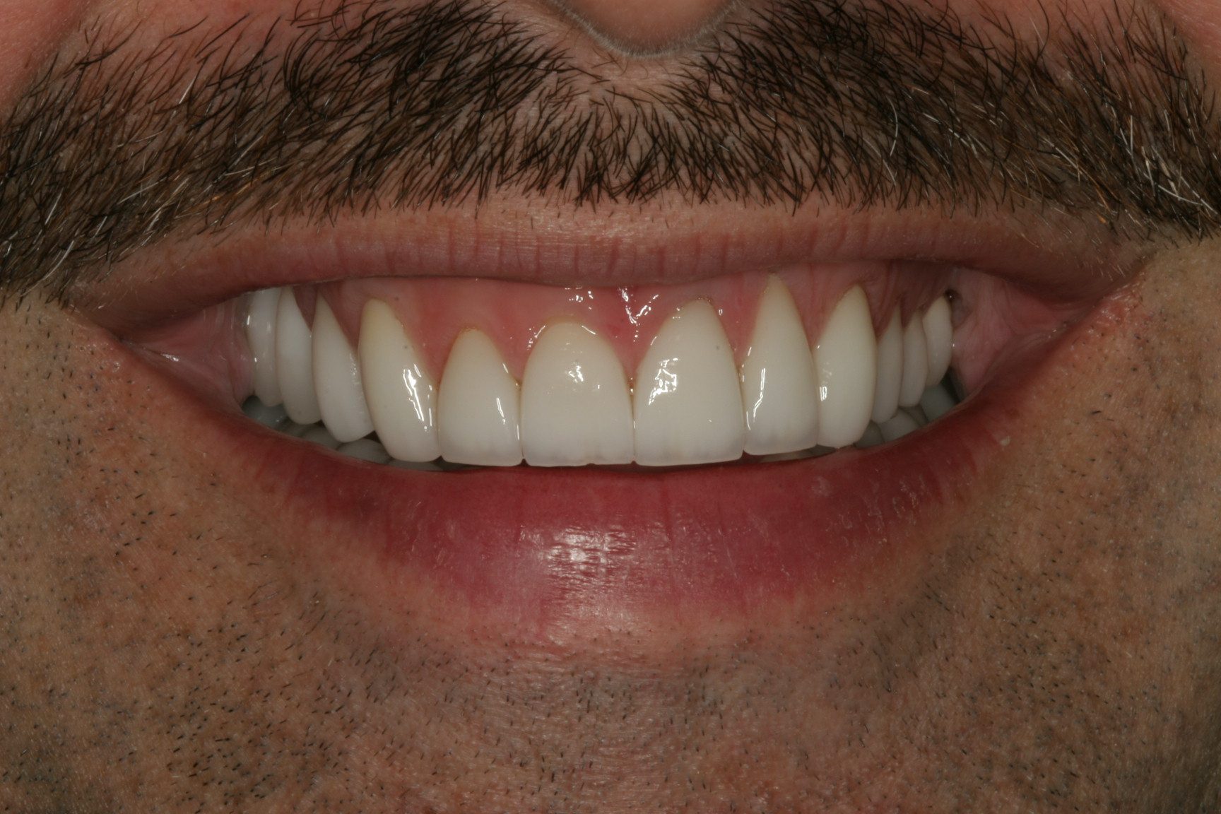 Client with straight, white teeth