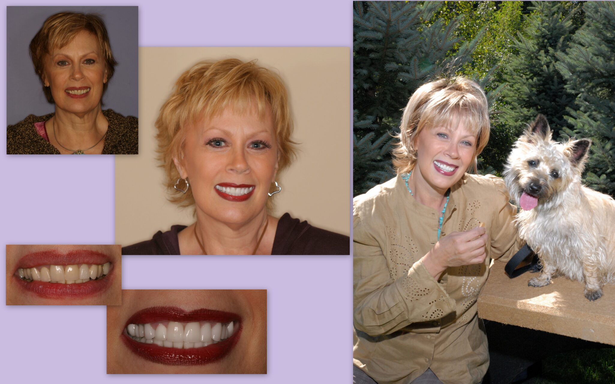 Photo collage of client before and after dental treatment