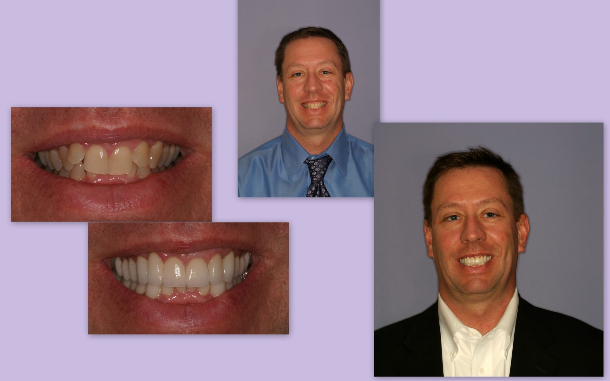 Before and after of male client