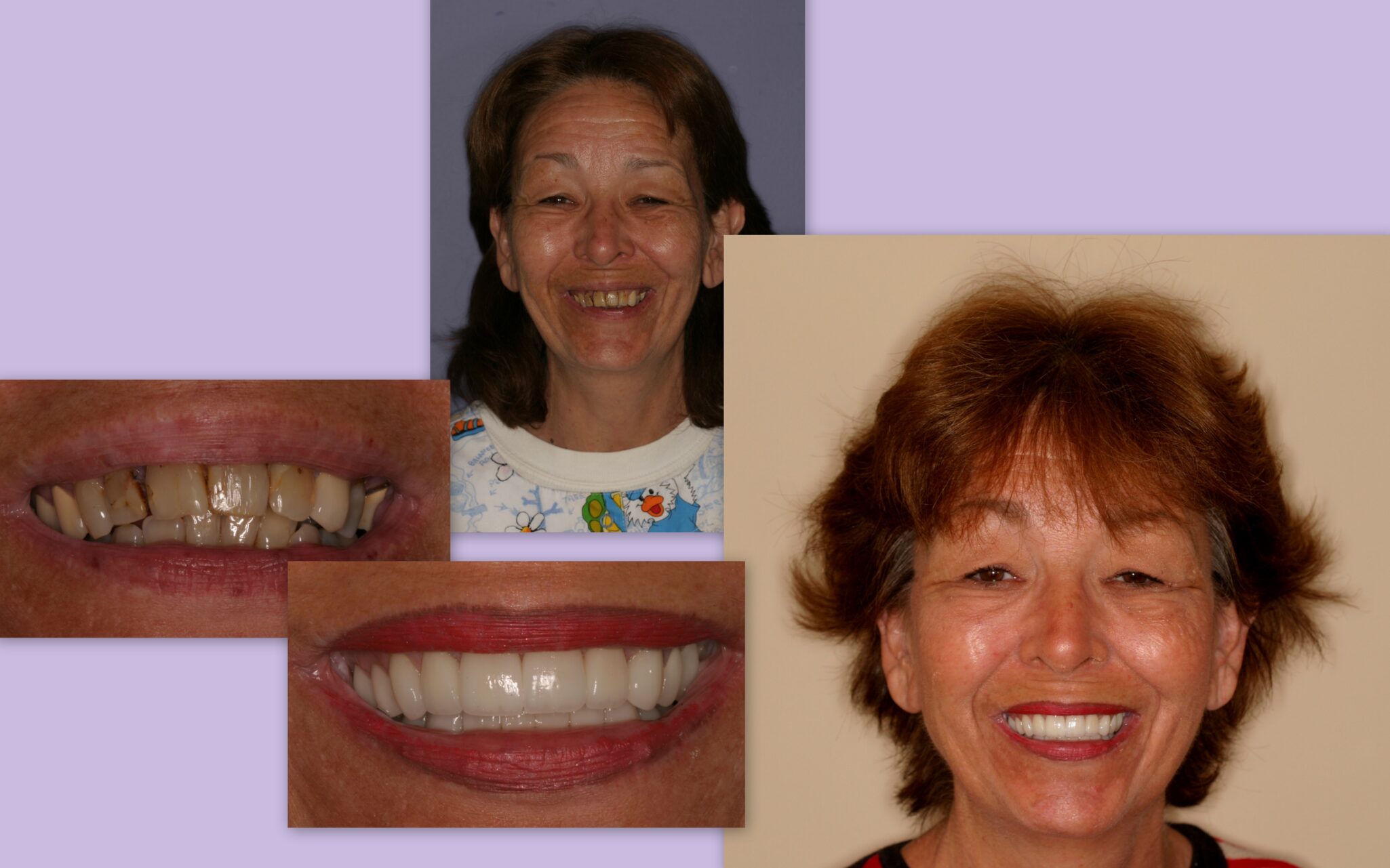 Before and after of female client