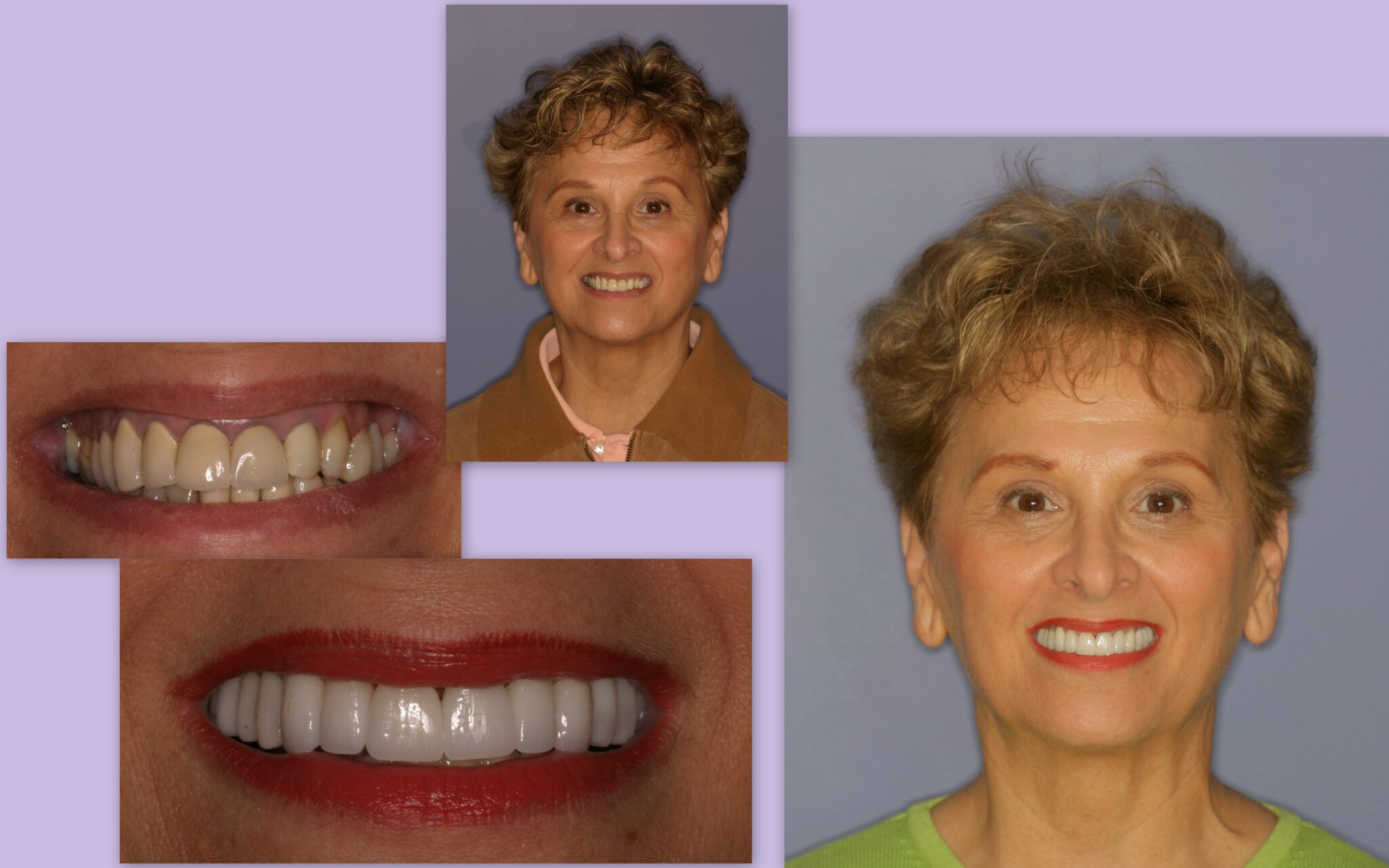 Before and after of female client