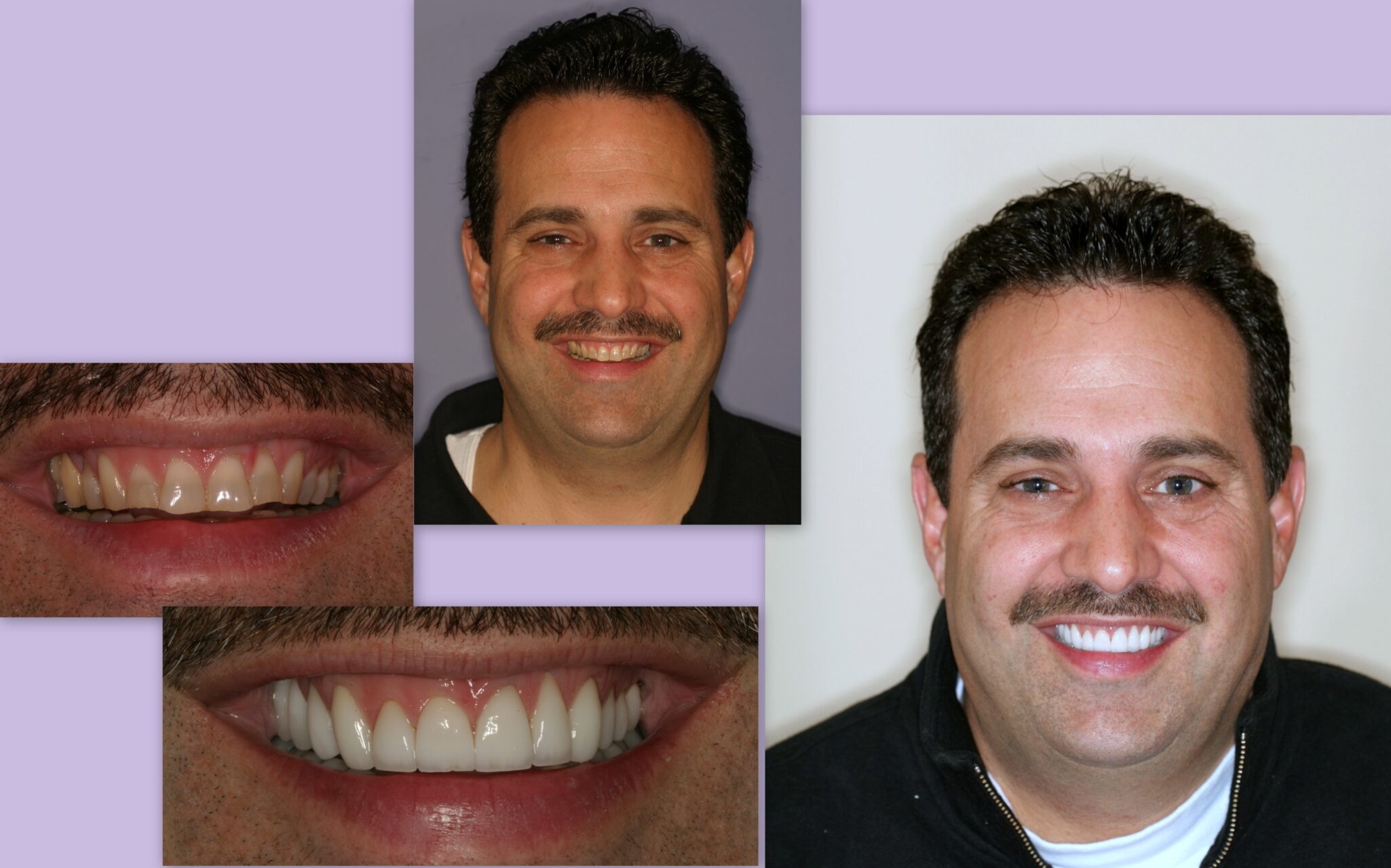 Before and after of male client