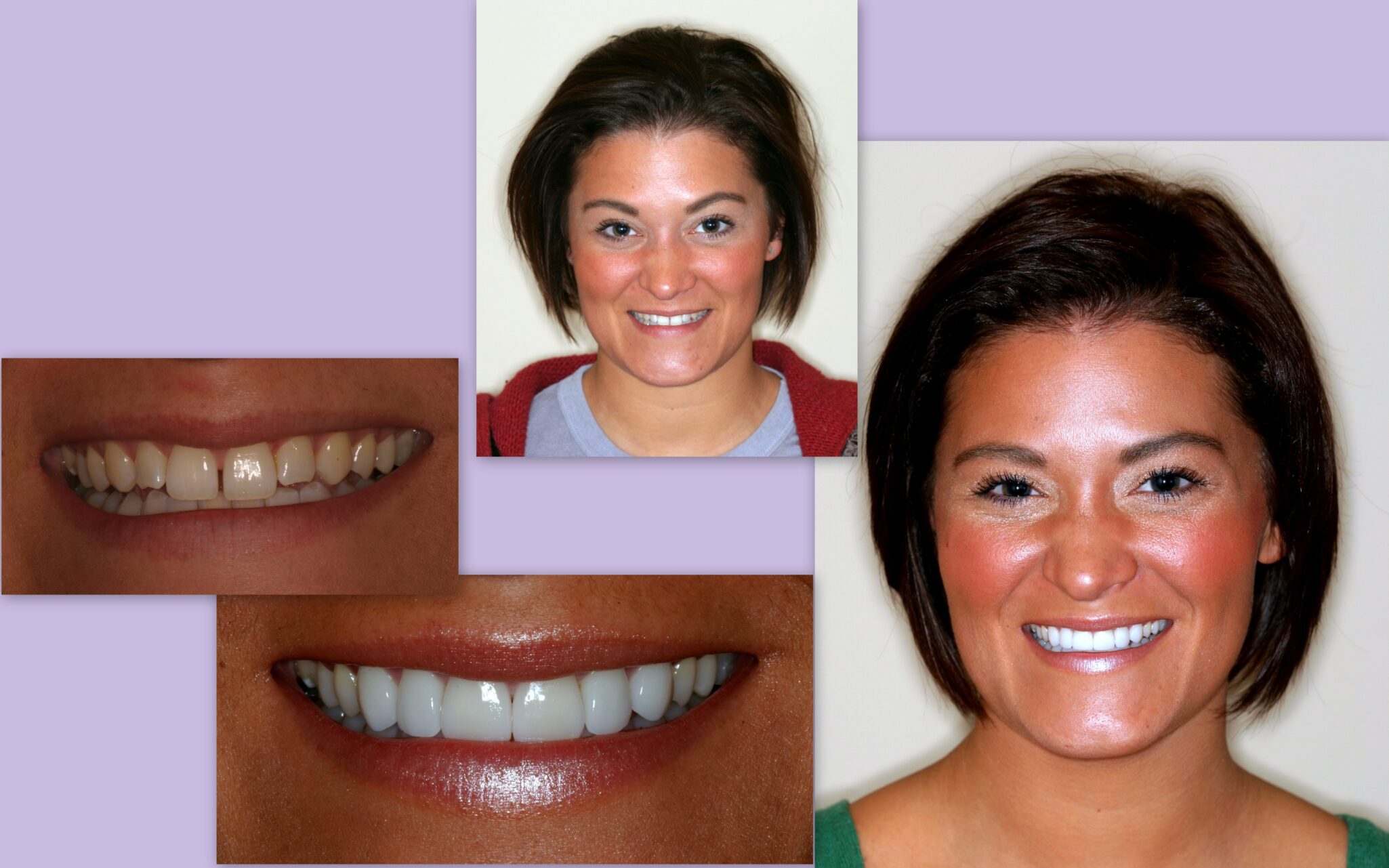 Before and after of female client