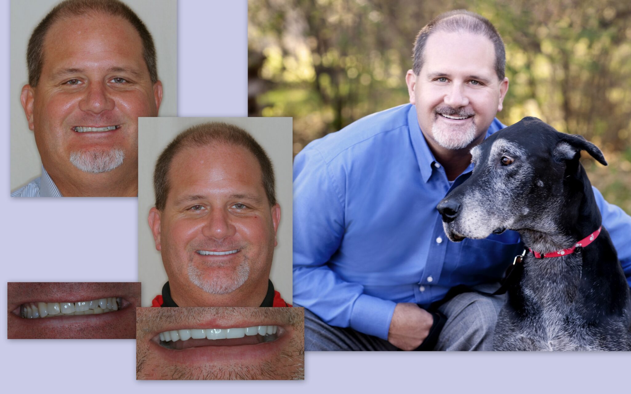 Before and after photo of middle aged male client