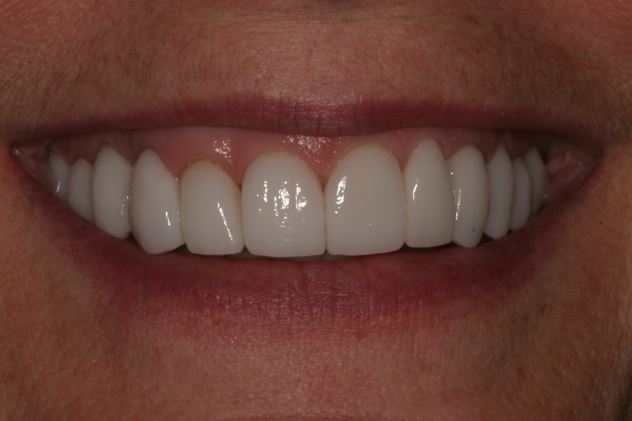 Straight, white teeth