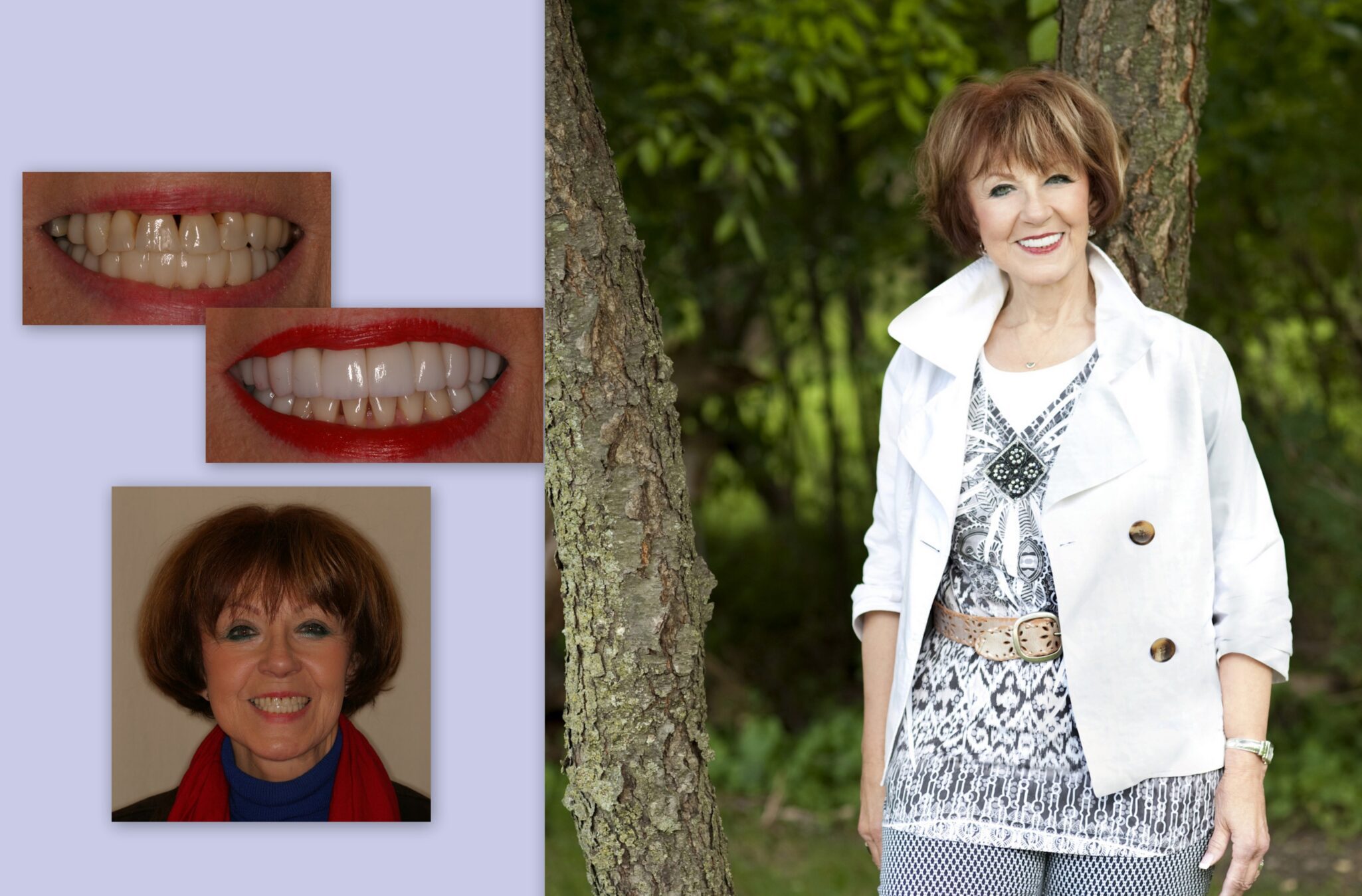 Before and after dental photos of mature female client