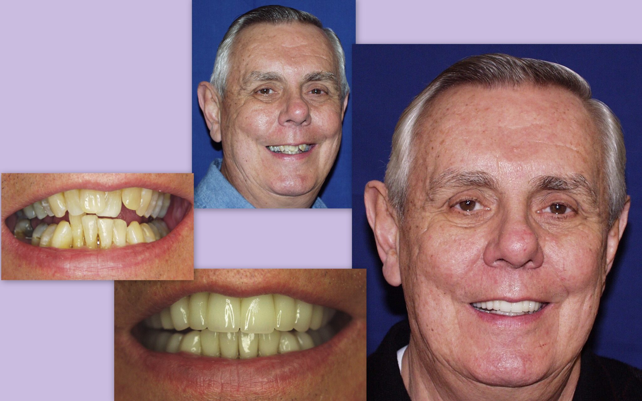 Before and after image of older male client