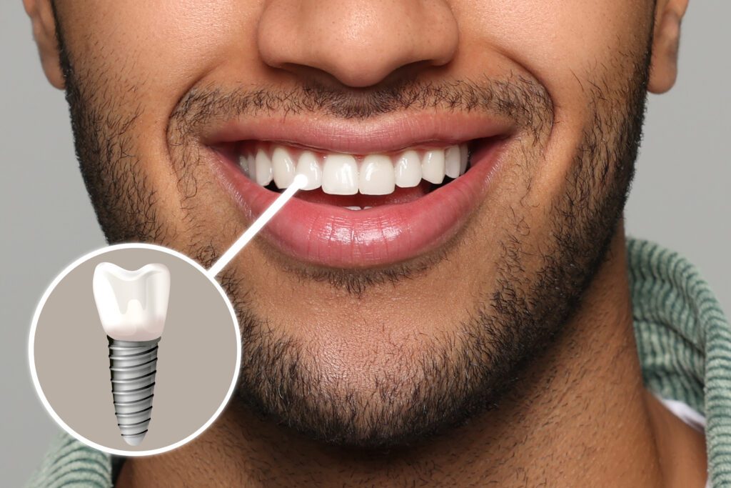 Where Lasting Smiles Begin -
