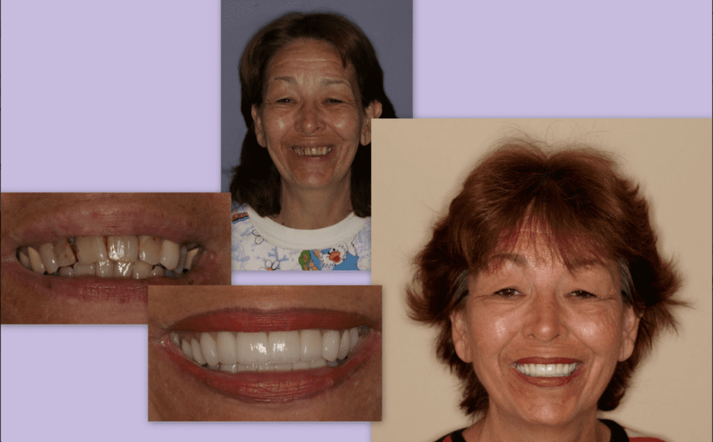 Where Lasting Smiles Begin - Cosmetic Dentistry