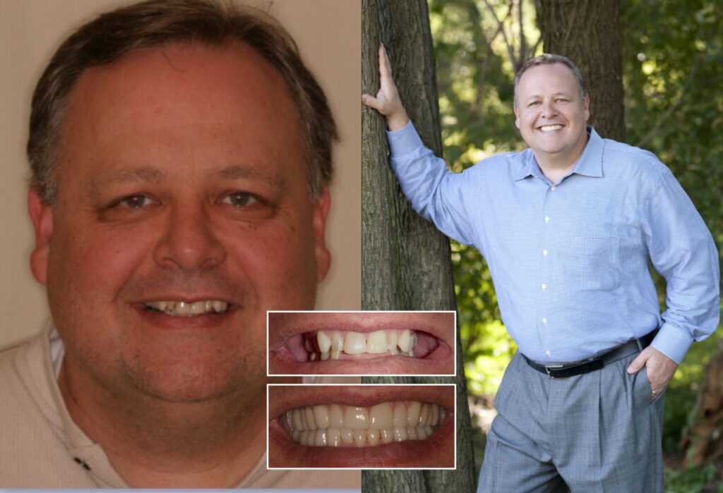 Where Lasting Smiles Begin - Cosmetic Dentistry